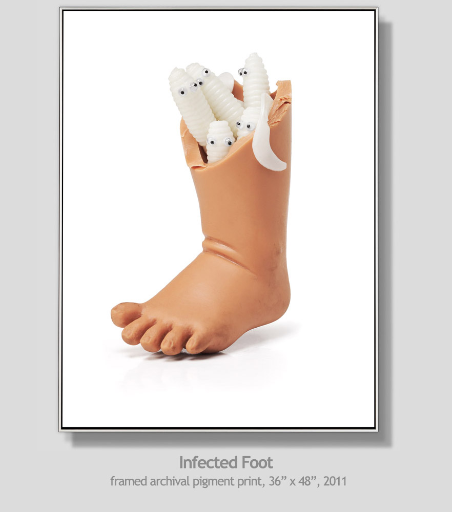 infected foot